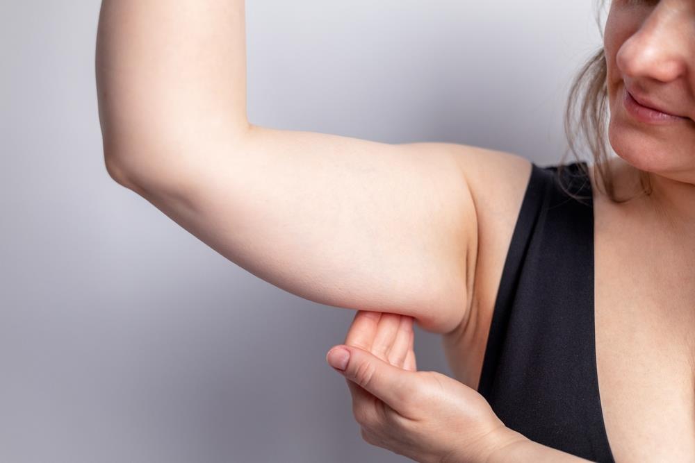 El ejercicio que recomiendan expertos para fortalecer brazos y ponerle fin a las alas de murciélago